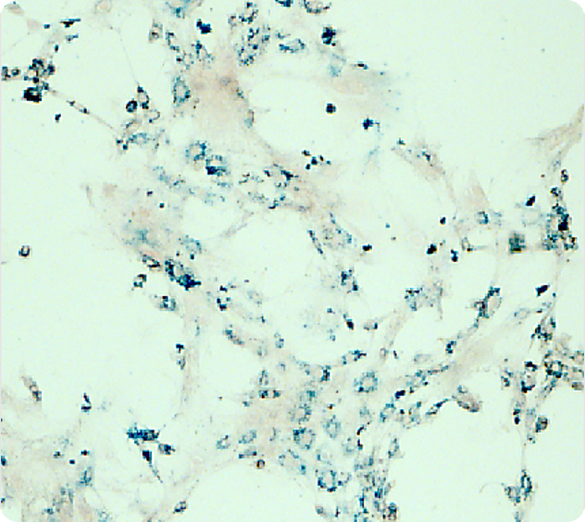 hMSCs marquées par SUPERSPIO. Crédit: JWM Bulte, JHU