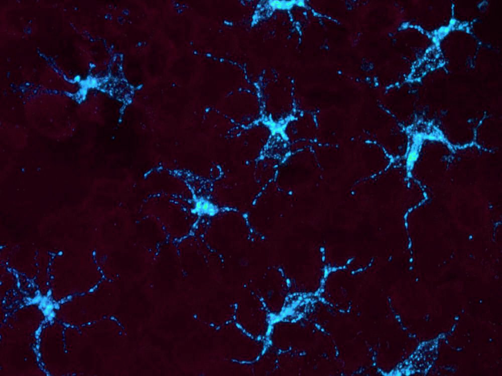website background Superbranche delphine felder-flesch sylvie Begin-Colin IPCMS CNRS iron stearate nanomatériaux architecturés nanoparticules magnétiques dendrimères dendritiques diagnostic précoce thérapie ciblée oncologie cancer startup nanotechnologie nanomédecine biotechnologie innovation injection intraveineuse imagerie médicale